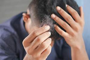 Hair Loss Treatment Trends Appealing to Men in 2024