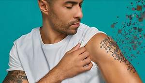 Traditional vs. Laser Tattoo Removal: Comparing Your Options